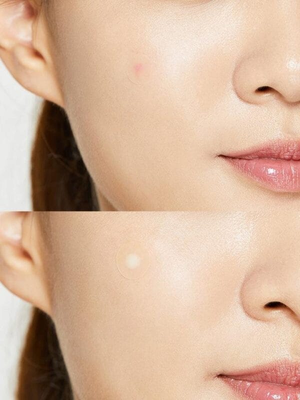 Cosrx Acne Pimple Master Patch2.jpg